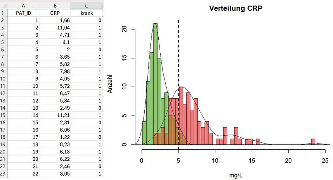 Tabelle und Histogramm zur Verteilung von CRP-Werten (mg/L) bei Patient:innen, mit farblicher Unterscheidung gesunder und kranker Gruppen sowie markierter Entscheidungsgrenze.
