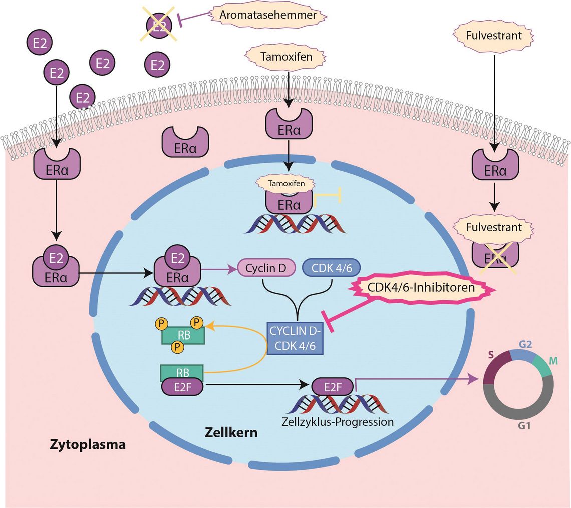Schematische Darstellung des Wirkungsmodells von CDK4/6-Inhibitoren im Brustkrebs: Östrogen aktiviert den ERα-Signalweg und die Zellzyklus-Progression, während Aromatasehemmer, Tamoxifen, Fulvestrant und CDK4/6-Inhibitoren gezielt diese Signalwege blockieren.