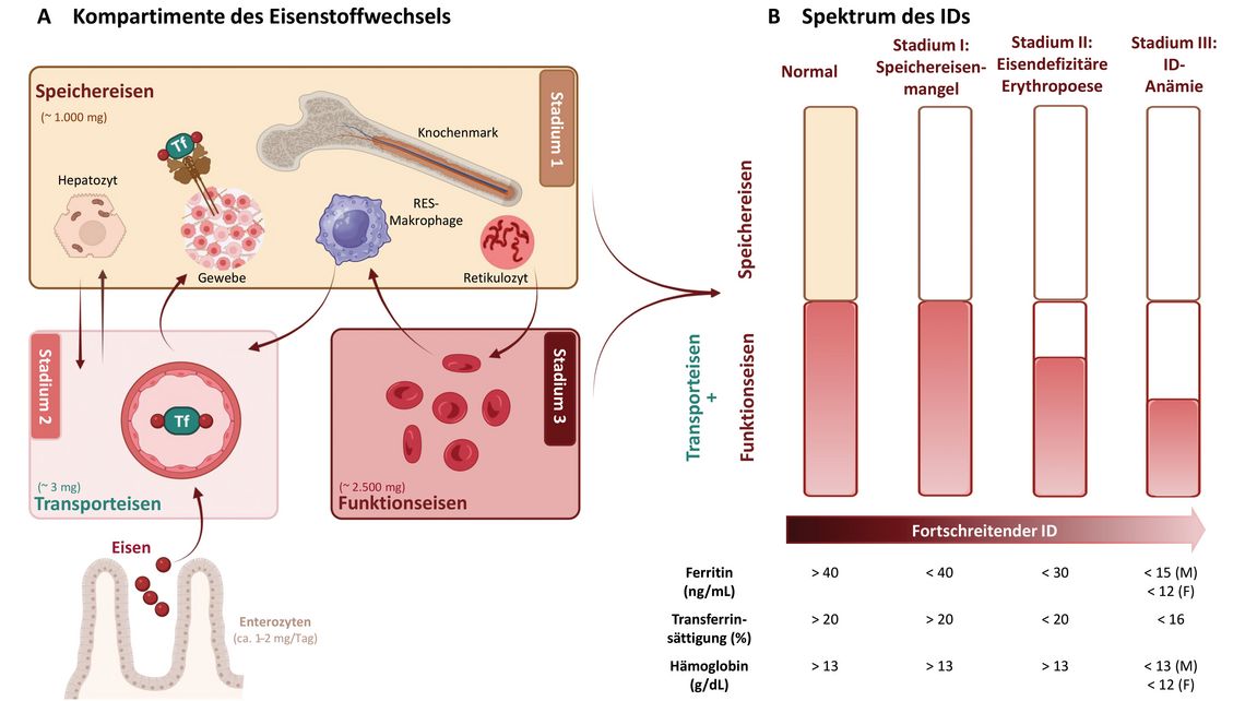 Grafik zu den drei Kompartimenten des Eisenstoffwechsels (Speichereisen, Transporteisen, Funktionseisen) und deren Veränderungen bei Eisenmangel bis hin zur Eisenmangelanämie.