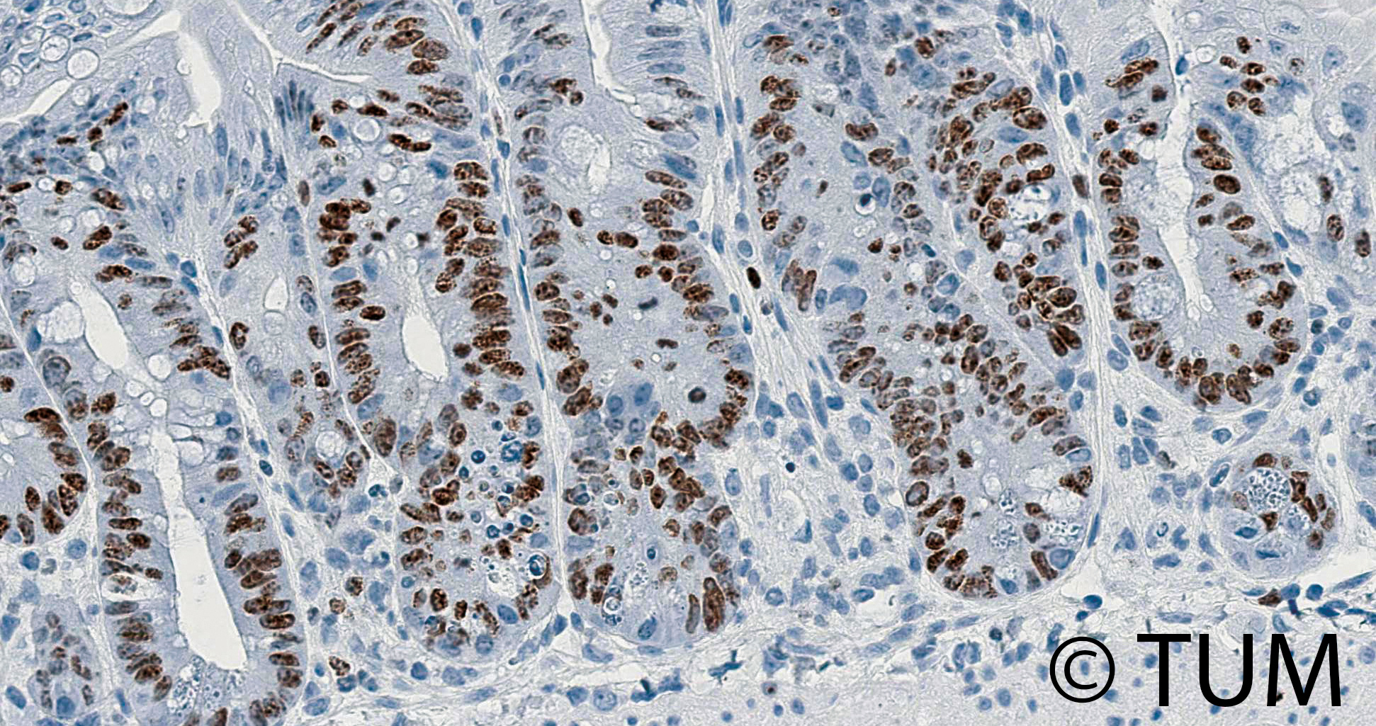 Mikroskopische Aufnahme von Darmepithel zeigt zahlreich braun gefärbte, proliferierende Zellen in den Kryptenstrukturen.
