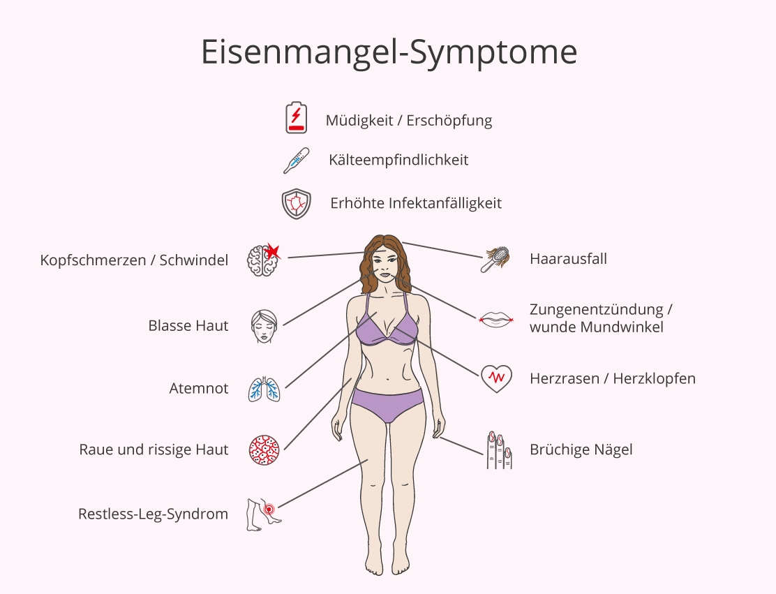 Illustration einer Frau in Unterwäsche mit Linien, die verschiedene Symptome von Eisenmangel aufzeigen. Die Überschrift lautet "Eisenmangel-Symptome". Symbole und Beschriftungen zeigen folgende Beschwerden: Müdigkeit/Erschöpfung, Kälteempfindlichkeit, erhöhte Infektanfälligkeit, Kopfschmerzen/Schwindel, blasse Haut, Atemnot, raue und rissige Haut, Restless-Leg-Syndrom, Haarausfall, Zungenentzündung/wunde Mundwinkel, Herzrasen/Herzklopfen und brüchige Nägel. Die Symptome sind grafisch durch Icons dargestellt und mit Linien auf die entsprechenden Körperbereiche der Frau verwiesen.