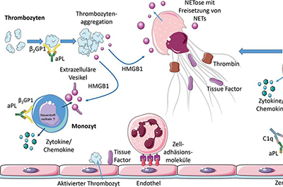 Darstellung der Wechselwirkungen zwischen Thrombozyten, Endothel- und angeborenen Immunzellen sowie dem Komplementsystem