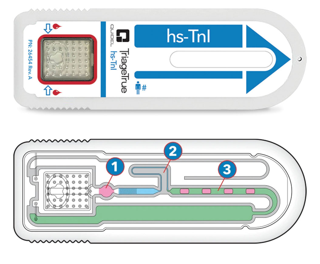 Darstellung eines Quidel TriageTrue hs-TnI-Testkassetten-Systems mit Außenansicht und schematischem Innenaufbau zur Probenanalyse.